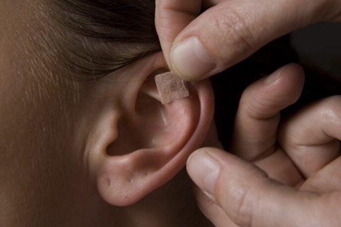 auriculothérapie Découverte de l'auriculothérapie