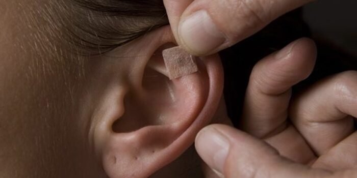 Découverte de l'auriculothérapie